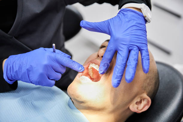 Best Emergency Dentist for Lost Fillings or Crowns in Glen Lyon, PA